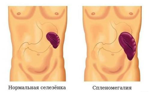 Первые признаки рака желудка. Первые признаки рака 04 Первые признаки рака желудка. Первые признаки рака 04
