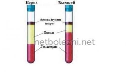 Врач рассказала о неожиданной пользе чеснока. 02 Врач рассказала о неожиданной пользе чеснока. 02