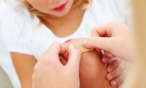 Как долго проходит ожог от крапивы. Как можно ускорить заживление ран