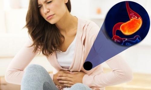 Ожог крапивой польза или вред. Какие продукты помогут победить изжогу