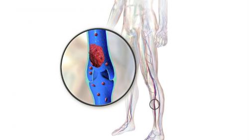 Эликвис или кардиомагнил. Александр Иванов, хирург-гинеколог