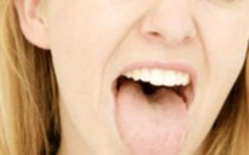 Как снять жжение во рту после острой еды. Жжение языка: причины, симптомы, лечение 02